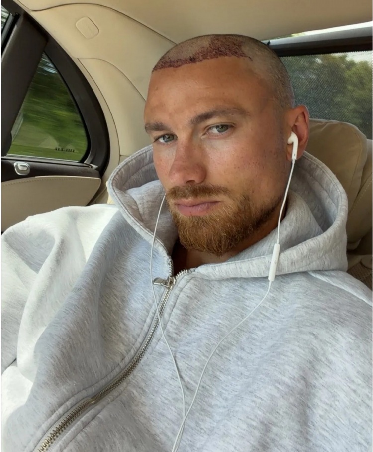卡什剃光头自曝植发，球迷调侃库库雷利亚或跟进